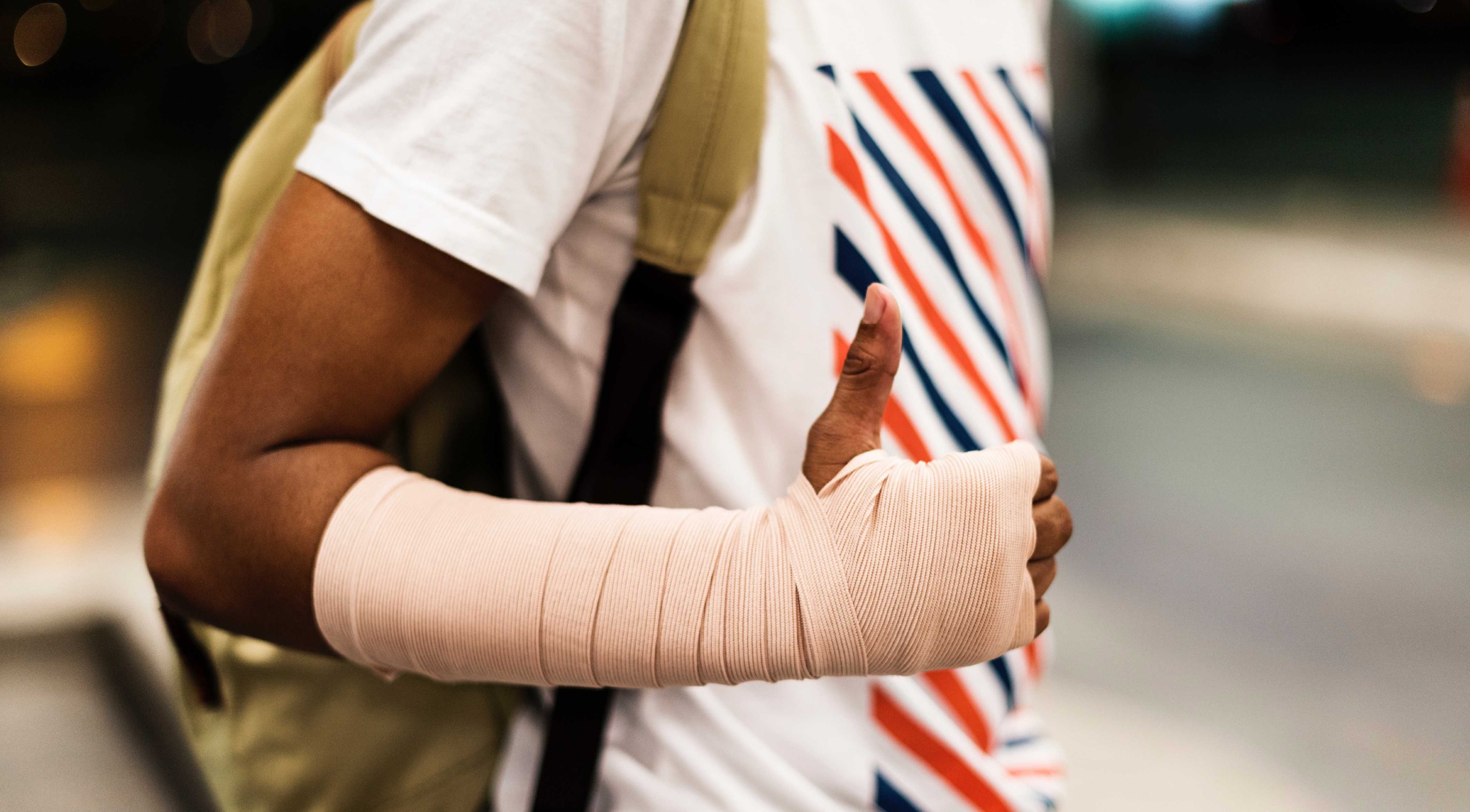 Primo piano di un braccio rotto di un utente dell'app di segnalazione degli incidenti.
